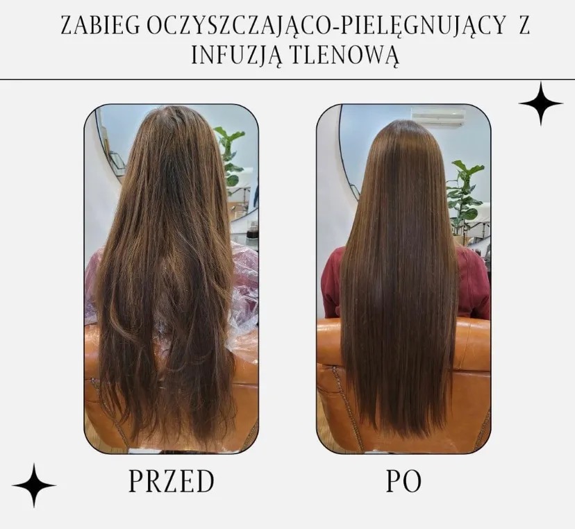 Efekt przed i po zabiegu trychologicznym na fotelu w gabinecie Hair&Spa w Suchym Lesie